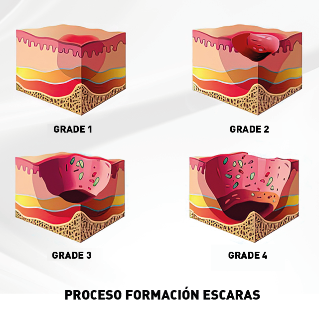 Colchón Antiescaras con Compresor CONFORT CARE