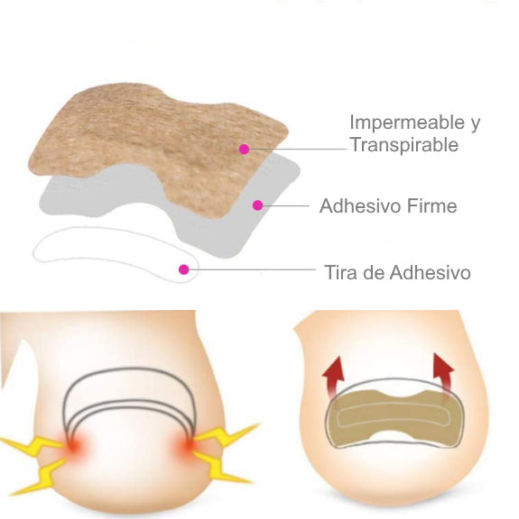 aposito-profesional-unas-encarnadas-ortoprime