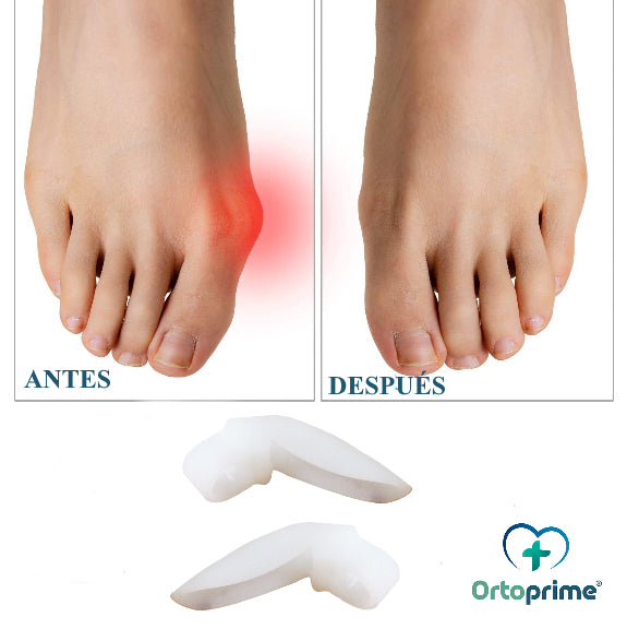 corrector-de-juanetes-ortoprime