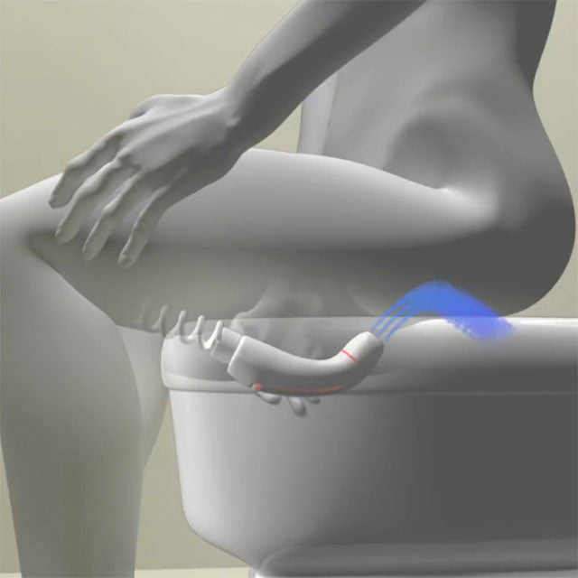 Ducha Teléfono Portátil para WC Higiene Íntima Unisex — OrtoPrime