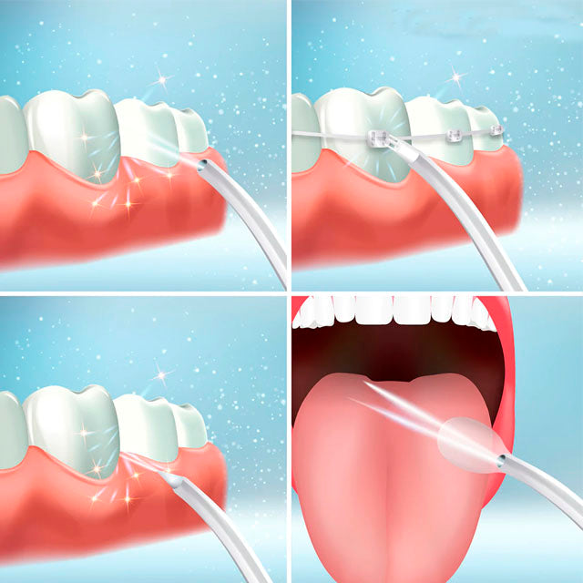 irrigador-bucal-cuatro-cabezales-ortoprime